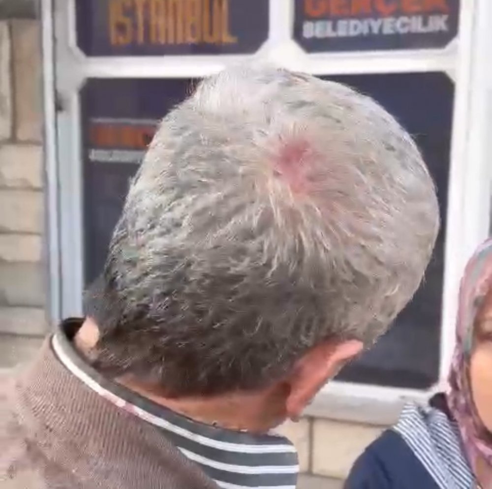 Broşür dağıtan AK Partili’yi darp olayında 6 gözaltı