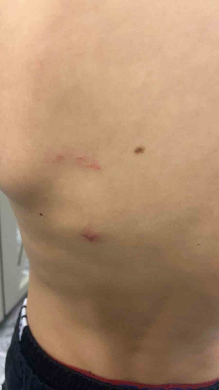 Okul bahçesinde beslenen köpekler öğrenciye saldırdı