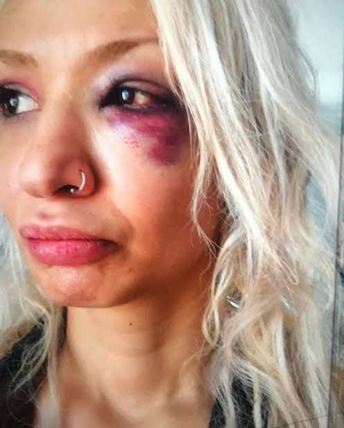Sevgilisini darp eden gitarist Can Tunaboylu 'isteyerek vurmadım' dedi