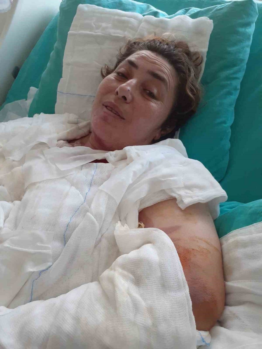 Düdüklü tencere hastanelik etti