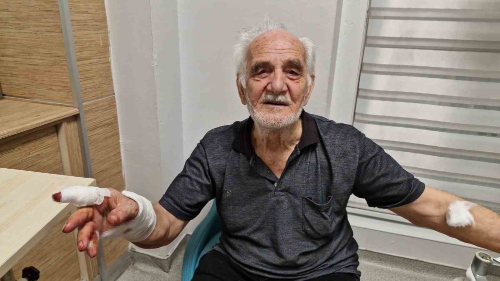 Zincirli çoban köpeği duvardan atlayıp yaşlı adamın elini parçaladı