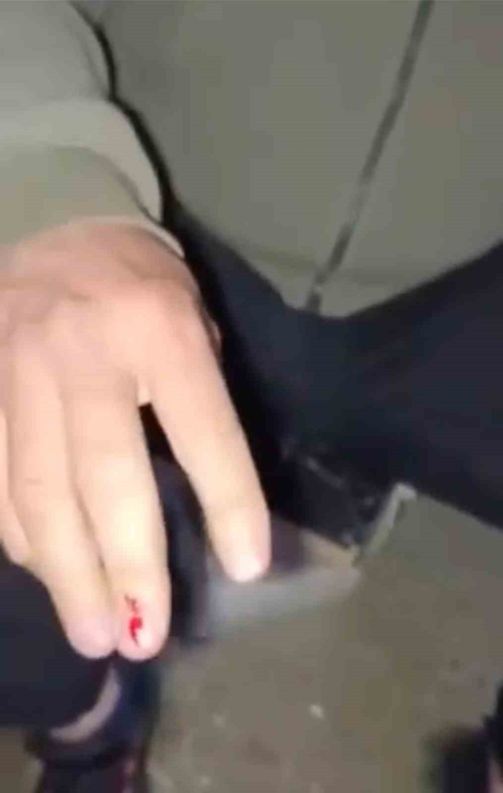 Bursa'da Aç Kalan Tilki Vatandaşı Isırdı: Kuduz Aşısı Yapıldı