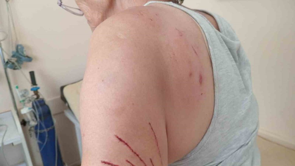 Köpeklerden sonra kediler de saldırmaya başladı