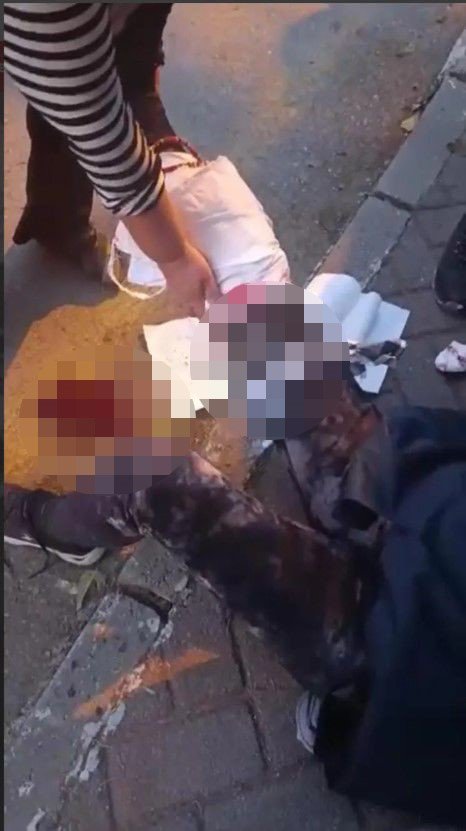 Yürüyüşten dönen akademisyene köpekler saldırdı: Mahalleli tepkili