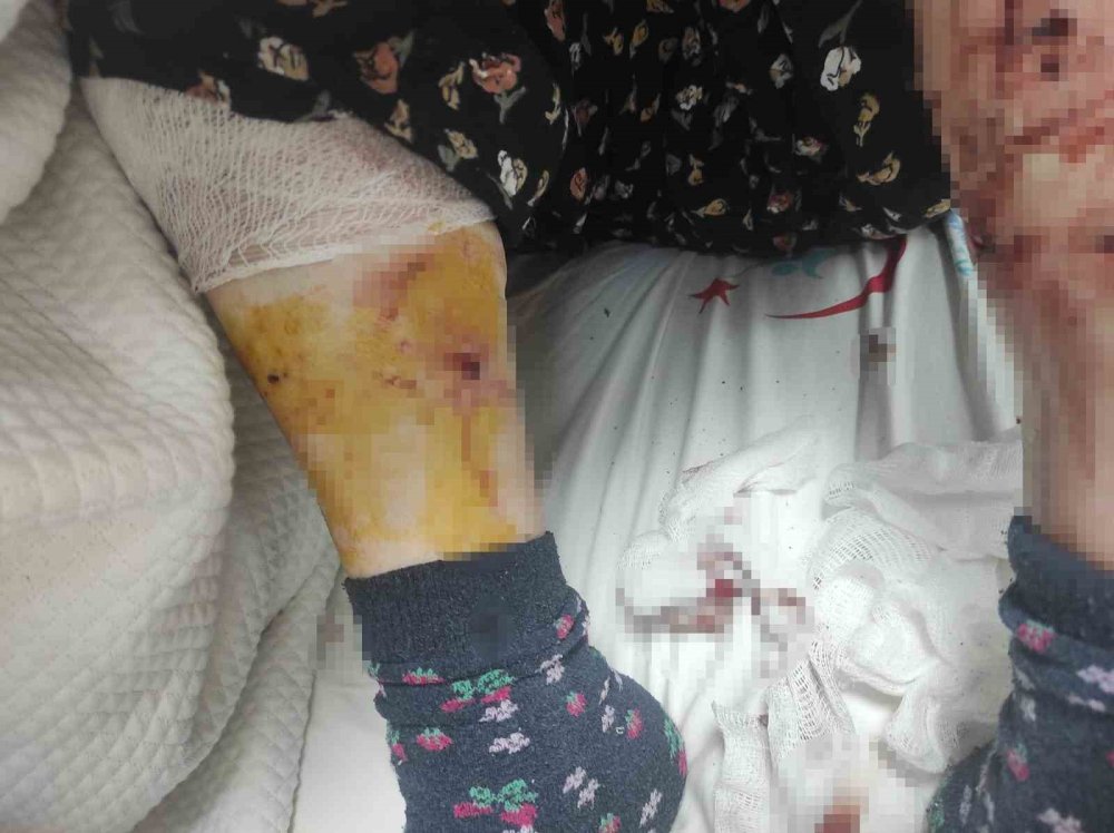 Bursa'da ortaya çıktı: Sokak köpeklerini toplamayan belediyenin cevabı merak konusu oldu