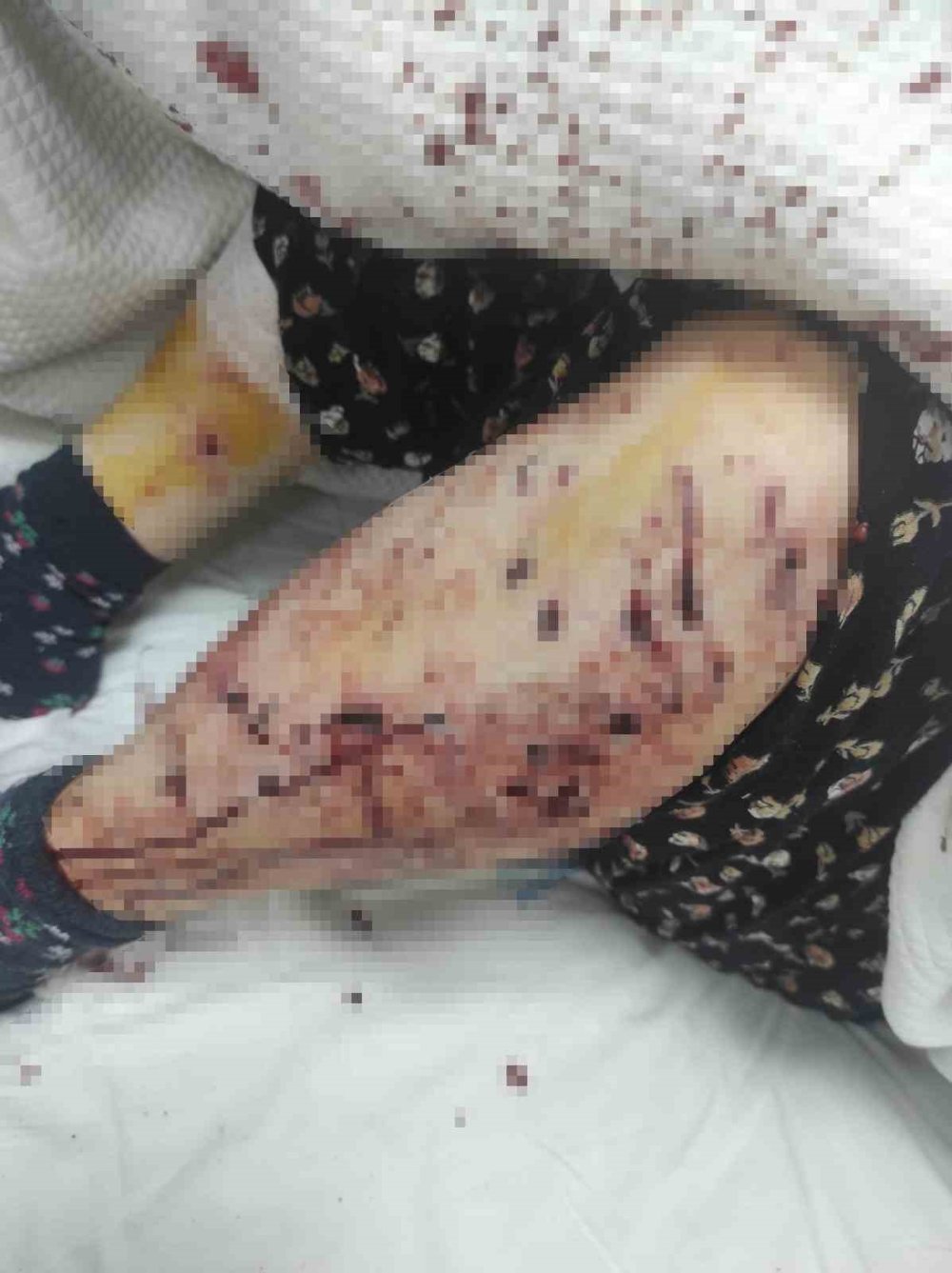 Bursa'da ortaya çıktı: Sokak köpeklerini toplamayan belediyenin cevabı merak konusu oldu