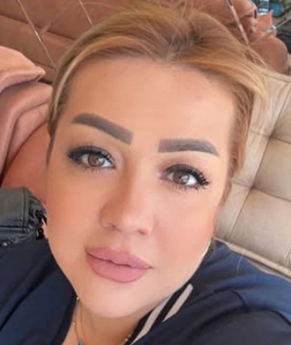 Botoks yaptıran kadın hastanelik oldu