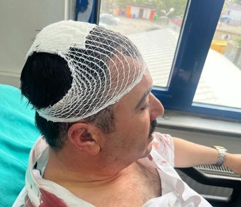 YRP'li başkan yardımcısı, belediye başkan yardımcısını şekerlikle yaraladı
