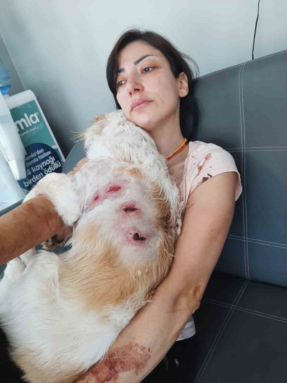 Köpeğiyle gezen genç kadına kangal saldırdı