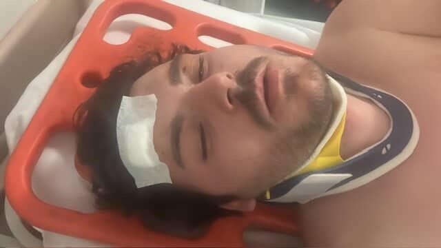 Trafik Tartışması Kavgaya Dönüştü: Oyuncu Mehmet Akif Akdeniz Darp Edildi