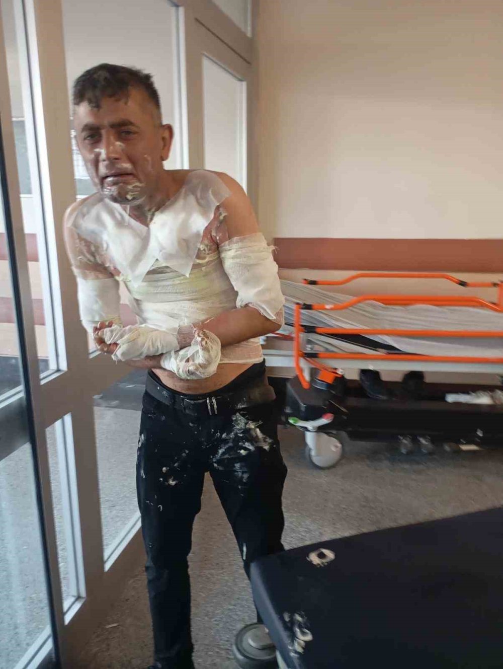 Benzin döküp ateşe verdi: Engelli vatandaşa dehşeti yaşattı