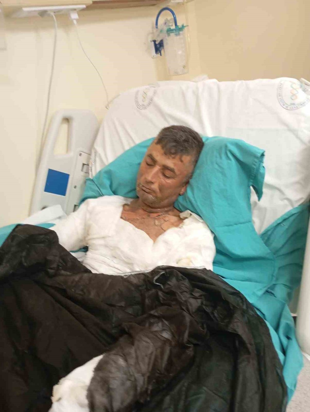 Benzin döküp ateşe verdi: Engelli vatandaşa dehşeti yaşattı