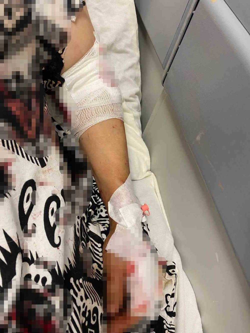 Abdest almaya çıktı, köpeklerin saldırısına uğradı