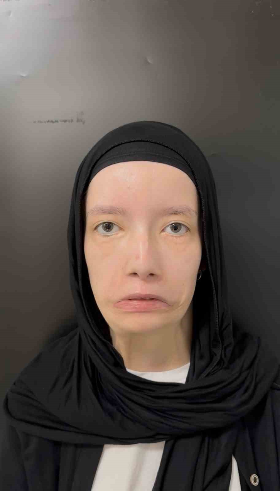 23 yaşındaki Kübra ilk kez gülümsedi