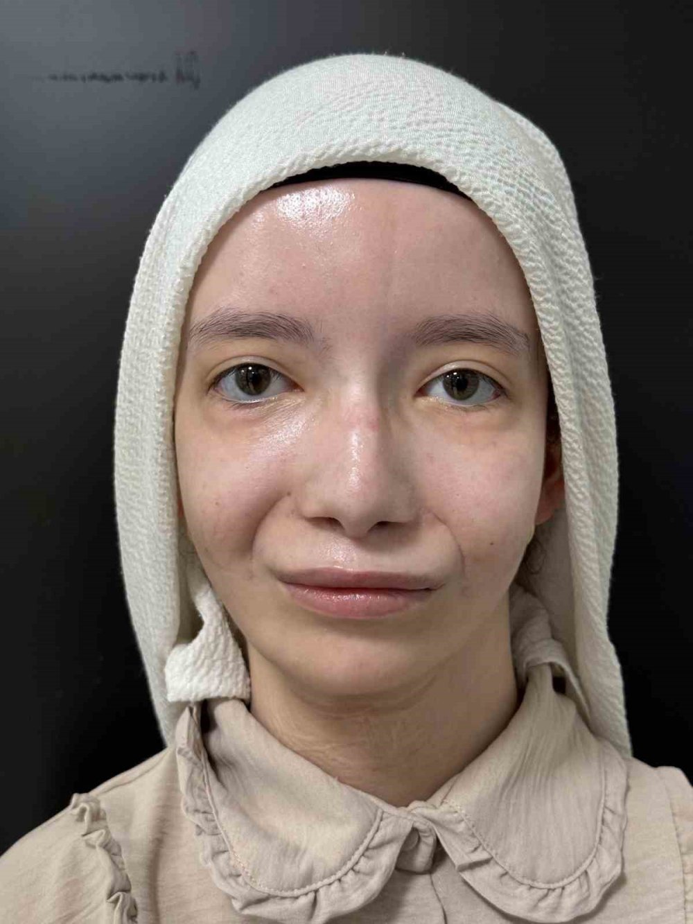 23 yaşındaki Kübra ilk kez gülümsedi