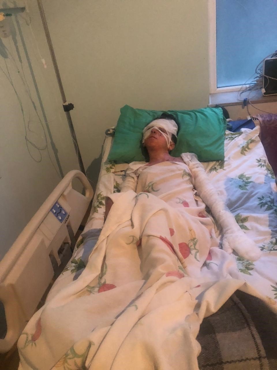 Aileleri İzin Vermedi Evlendiler! Yangında İkisi de Yandı Türkiye Şifa Oldu