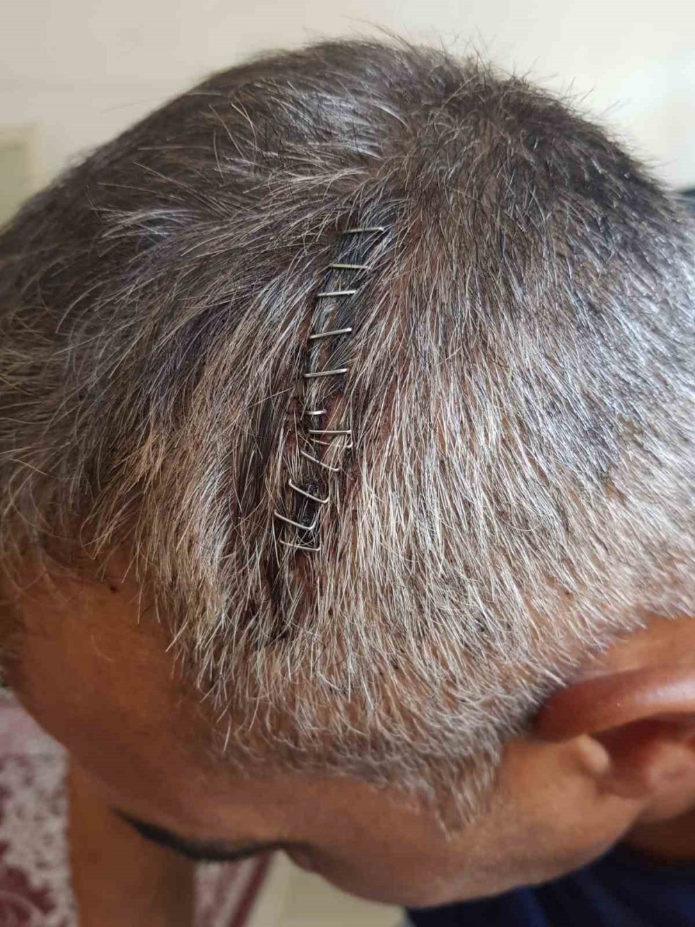 Eğlence dayakla bitti