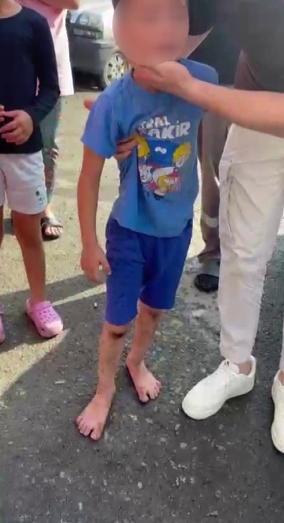 Beykozlular sokak köpekleri yüzünden yolda yürüyemez oldu