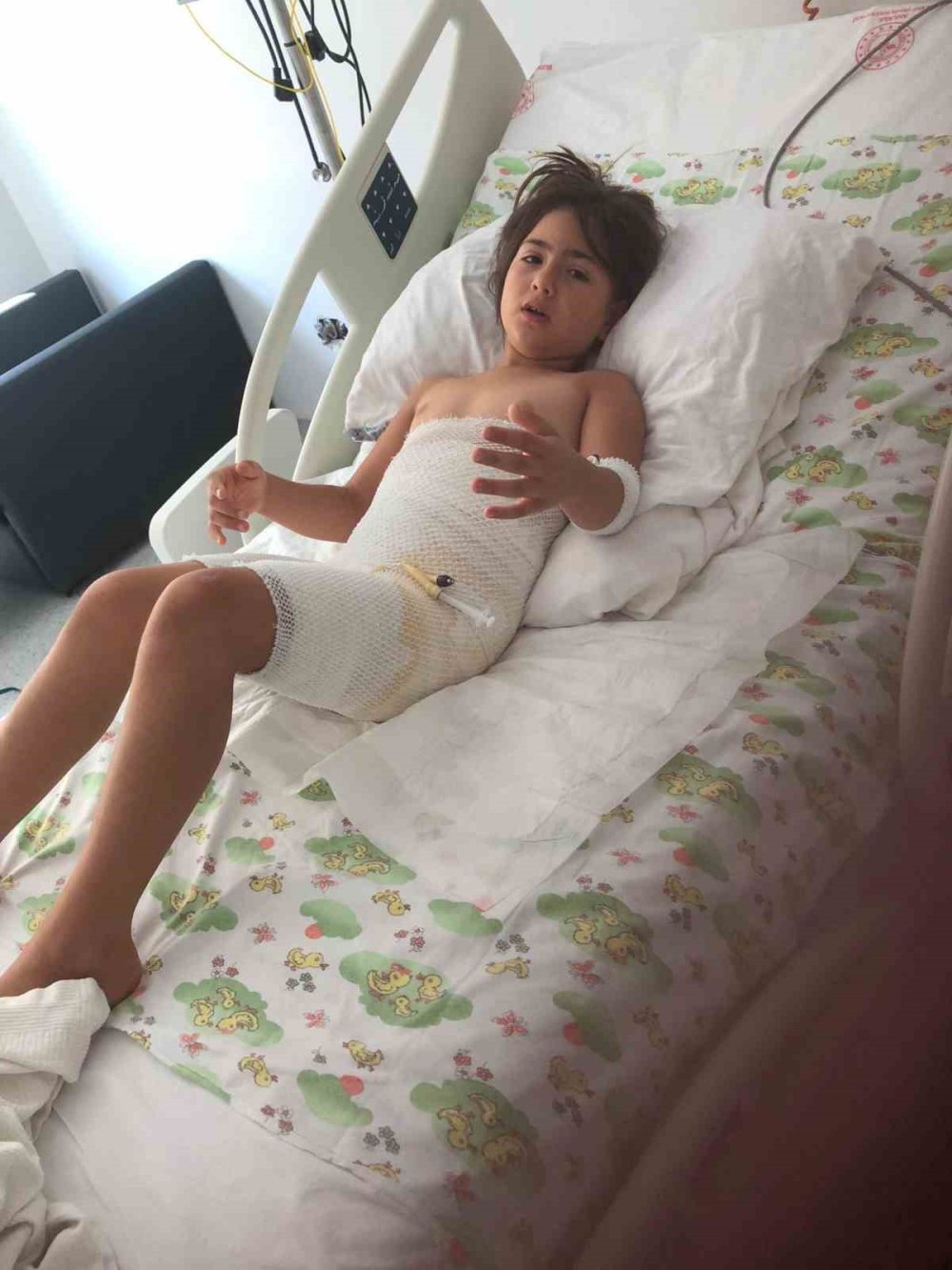 Üzerine sıvı azot dökülen 8 yaşındaki Elif, 7 operasyon geçirdi