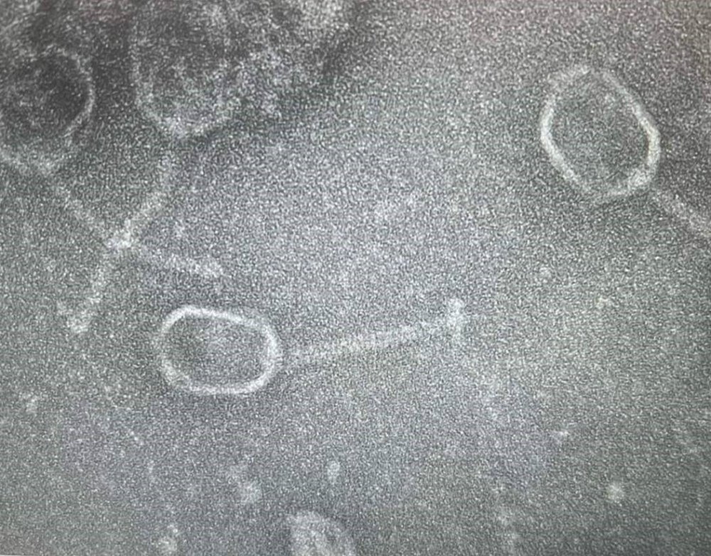 Kıbrıs'ta Keşfedilen "Alasiavirus", Dünya Bilim Literatürüne Girdi