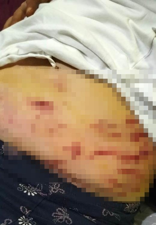 Mersin'de dehşet anları! Sahip çıkmadığı köpek saldırdı