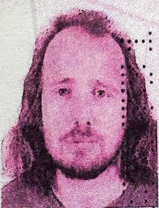 İngiliz vatandaşı, Türkiye’de saç ekimi ve diş tedavisi ardından hayatını kaybetti