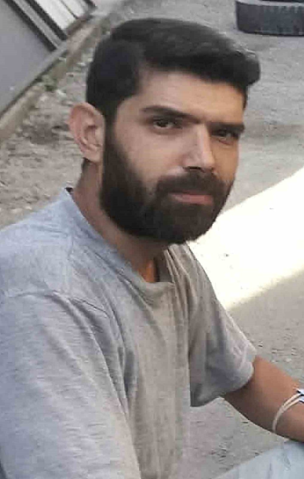 Ağır Yaralanan Takıntılı Eski Sevgili Ayhan Güneş Hayatını Kaybetti