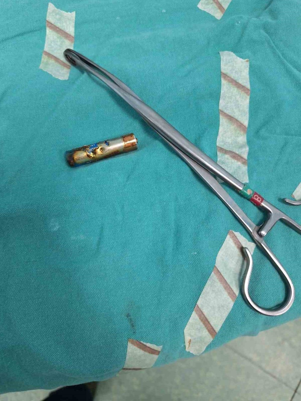 Kumanda pili yutan 6 aylık bebek son anda kurtarıldı