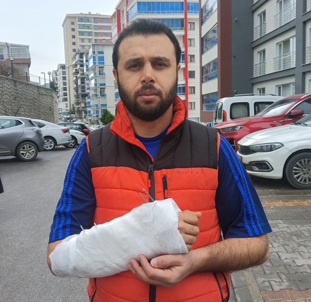 Köpeklerden kaçarken düştü fatura vatandaşa çıktı