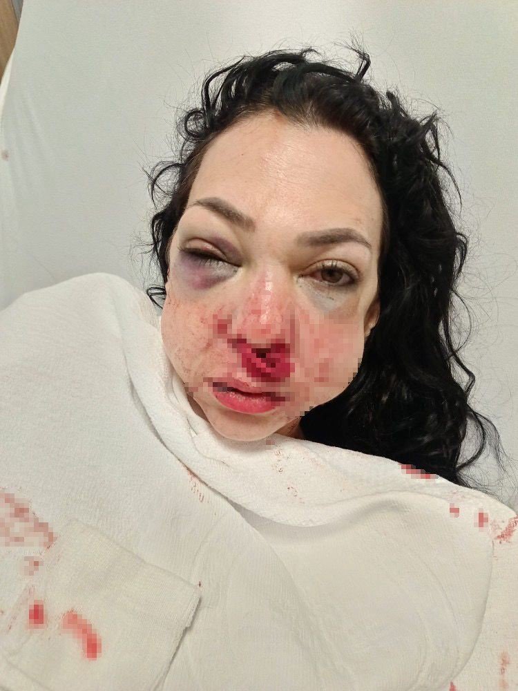 İnsanlıktan Çıktık! Oğlunun gözü önünde anneyi öldüresiye dövdüler