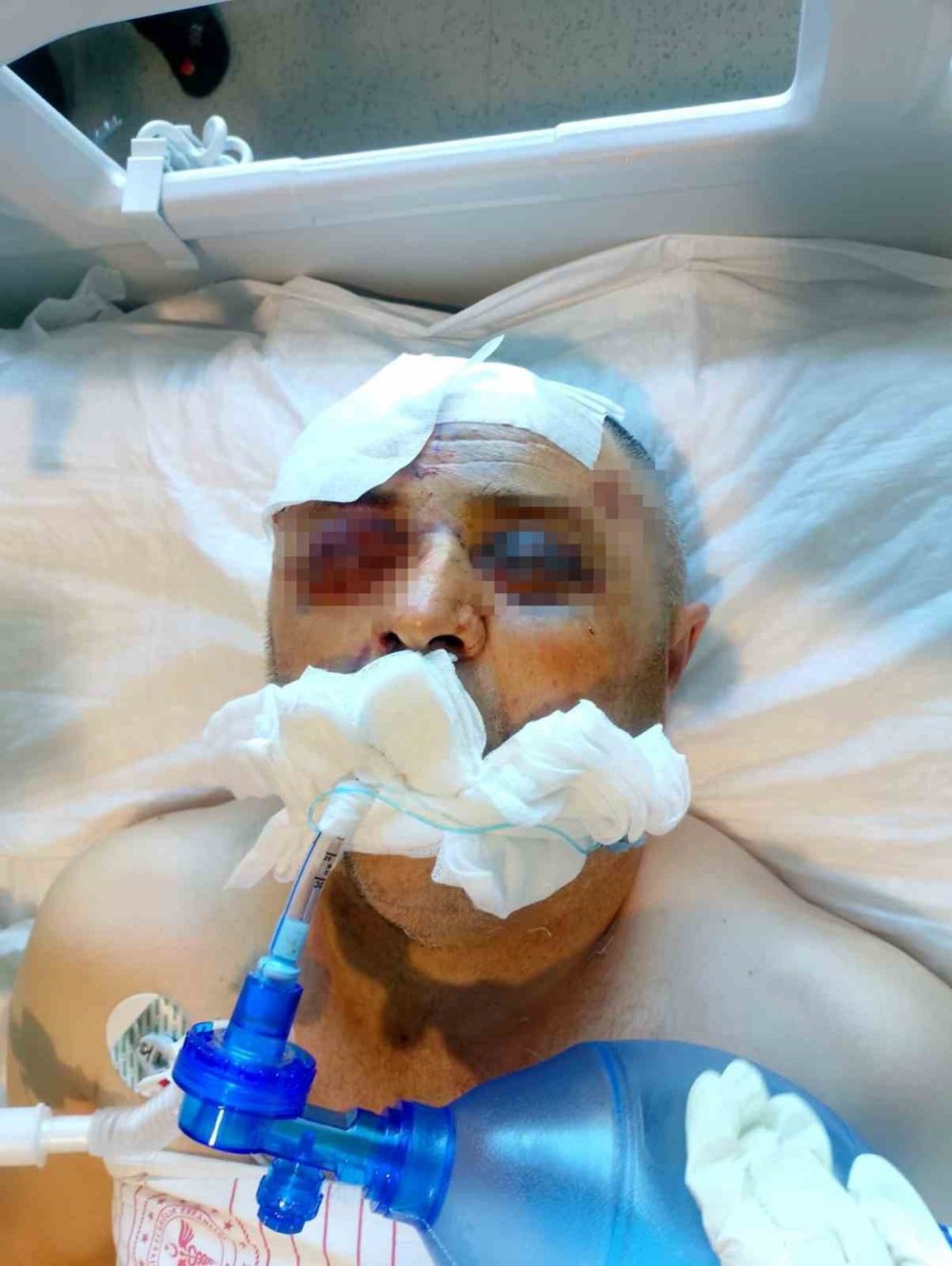 Demir Çubuklu Magandalar Yaşlı Adamı Ölüme Terk Etti!