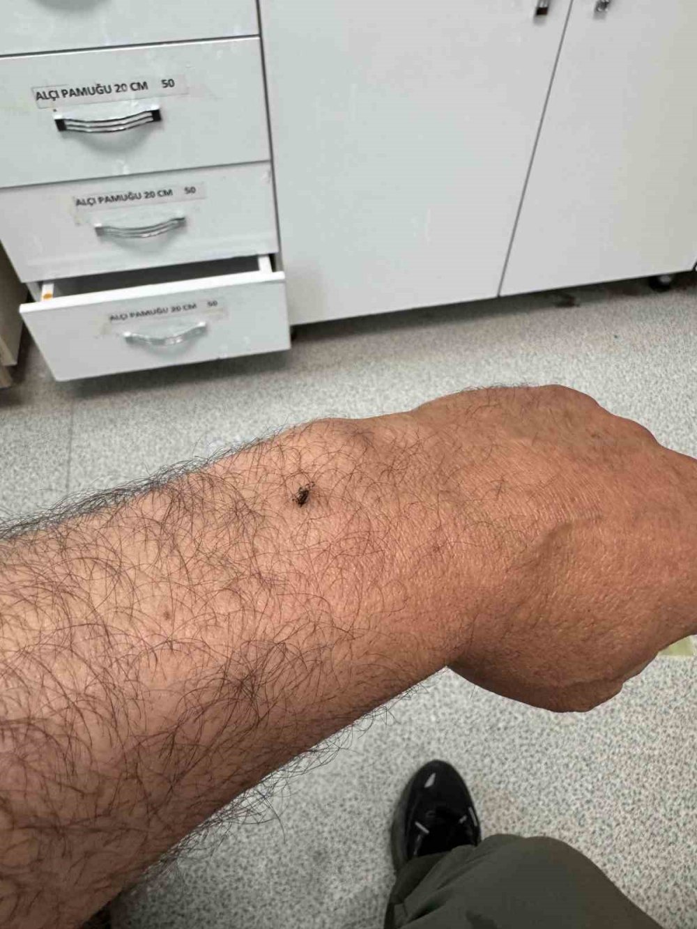 Koluna Kene Yapışan İtfaiyeci Soluğu Hastanede Aldı