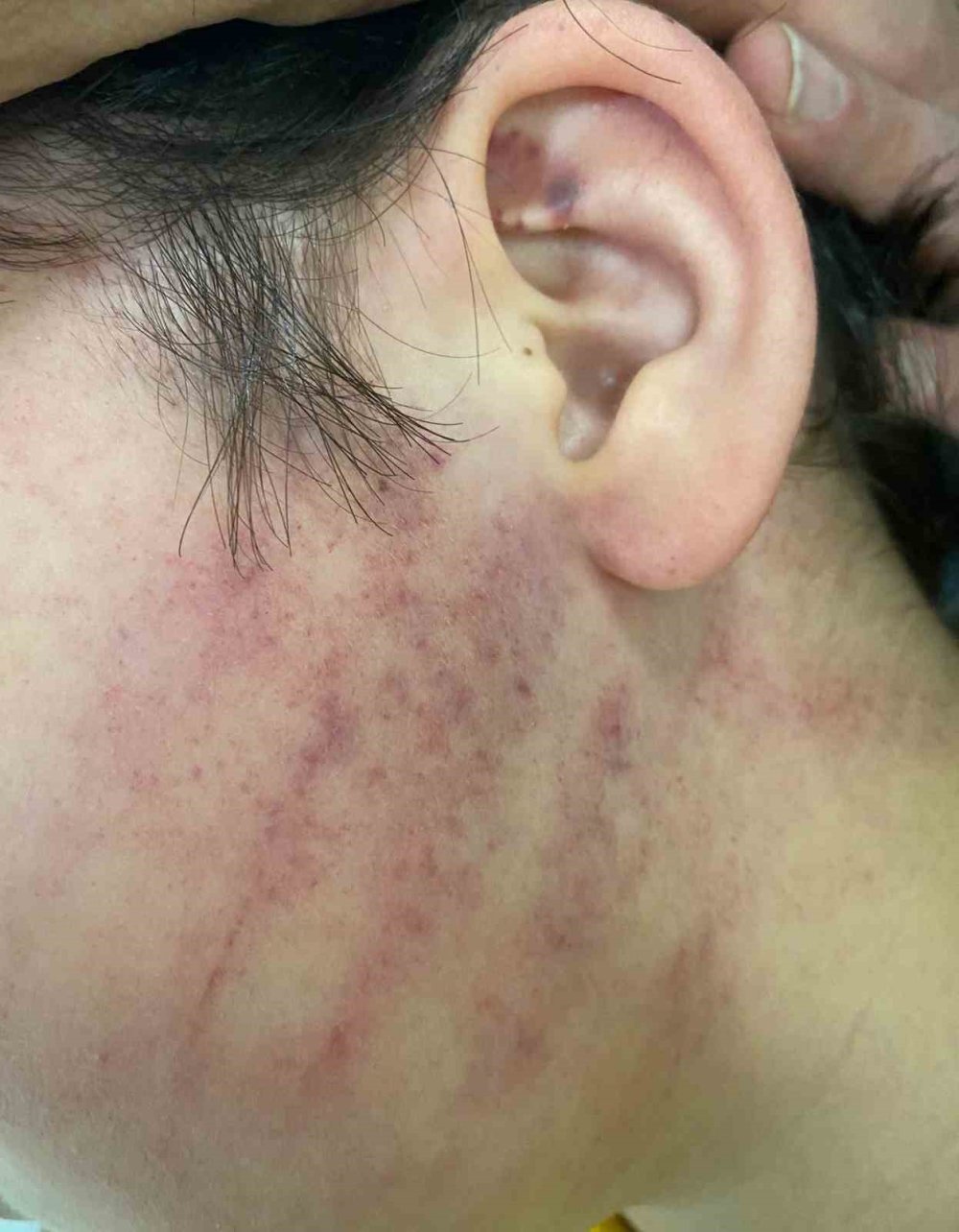 Sınıftaki Sıra Kavgasına Aileler Karıştı: Fırça Sapı İddianamede Silah Sayıldı