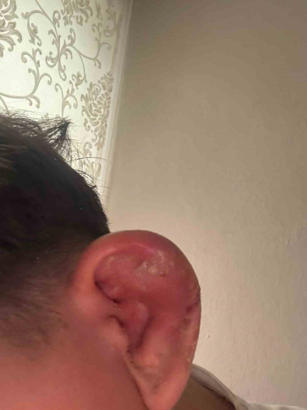 Piercing hevesi kabusa döndü