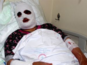 Temizlik yaparken dikkatsizlik kadını bu hale getirdi