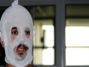 Merdiven altı krem bu hale getirdi