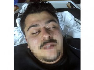 İki gün yarı baygın gezdi, kafasından mermi çıktı